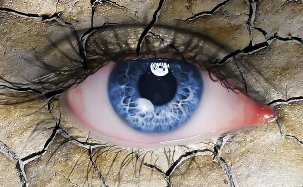 Göz Kuruluğu - Prof. Dr. Şeyhmus ARI - Gaziantep Göz Hastalıkları Uzmanı