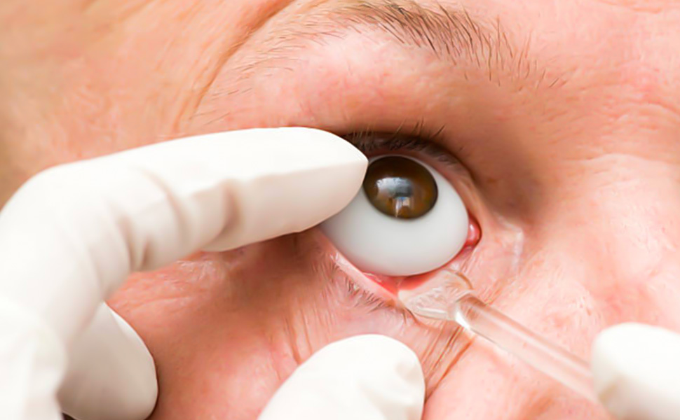 Protez Göz - Prof. Dr. Şeyhmus ARI - Gaziantep Göz Hastalıkları Uzmanı